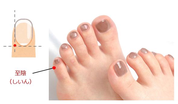 逆子の灸のツボ至陰