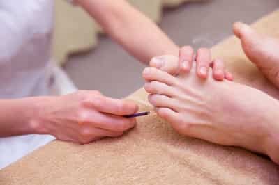 逆子の鍼灸(お灸) 逆子の鍼灸(お灸)