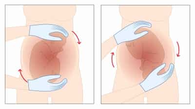 外回転術 外回転術