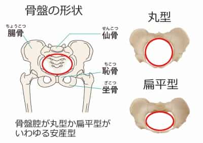 骨盤の形状 骨盤の形状