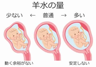 羊水の量 羊水の量