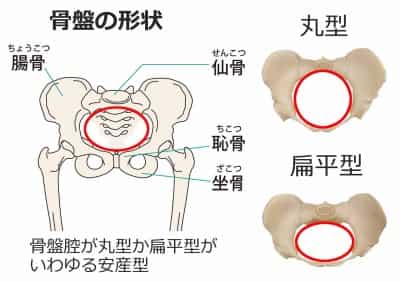 骨盤の形状（安産型）